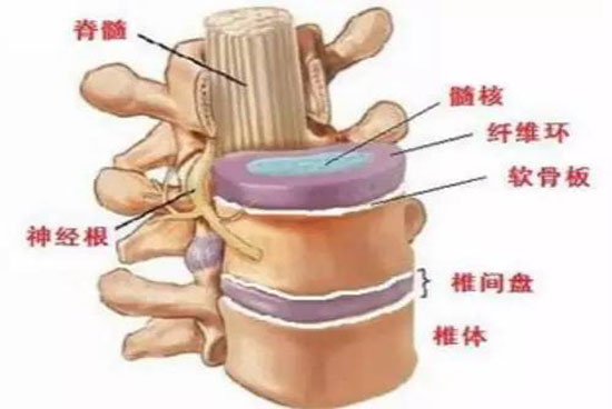 牵引床